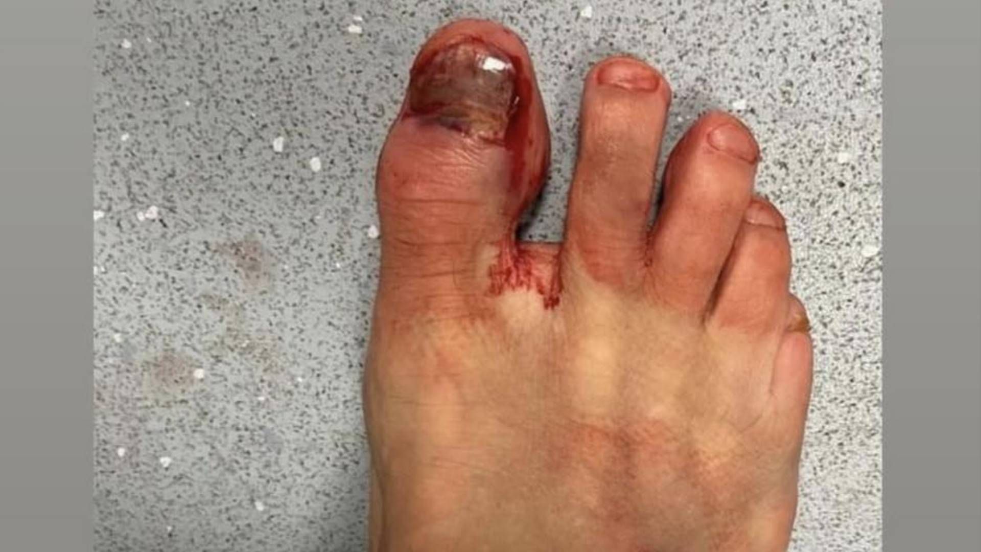 Alluce-Felipe-Anderson