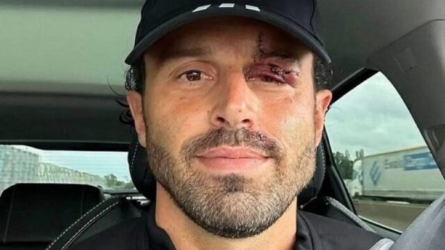Fabio Grosso ferita Lione