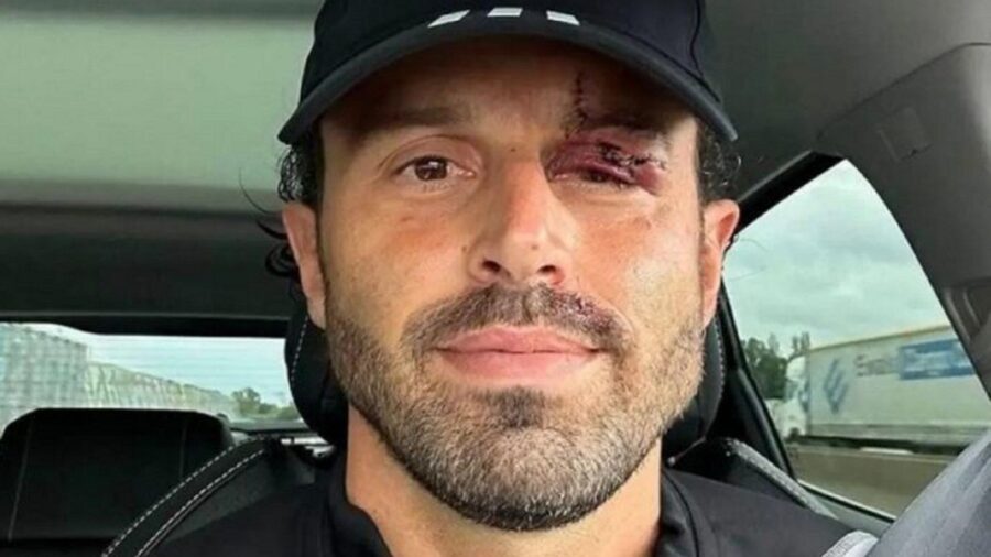 Fabio Grosso ferita Lione