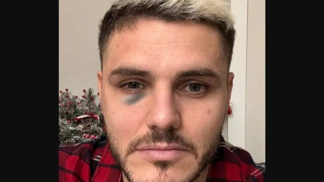 Icardi frattura