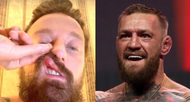 Facchinetti mcgregor