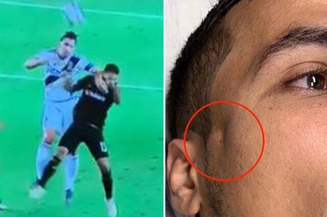 Ibrahimovic rompe la faccia