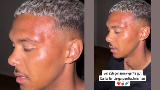 Sommer norimberga aggressione