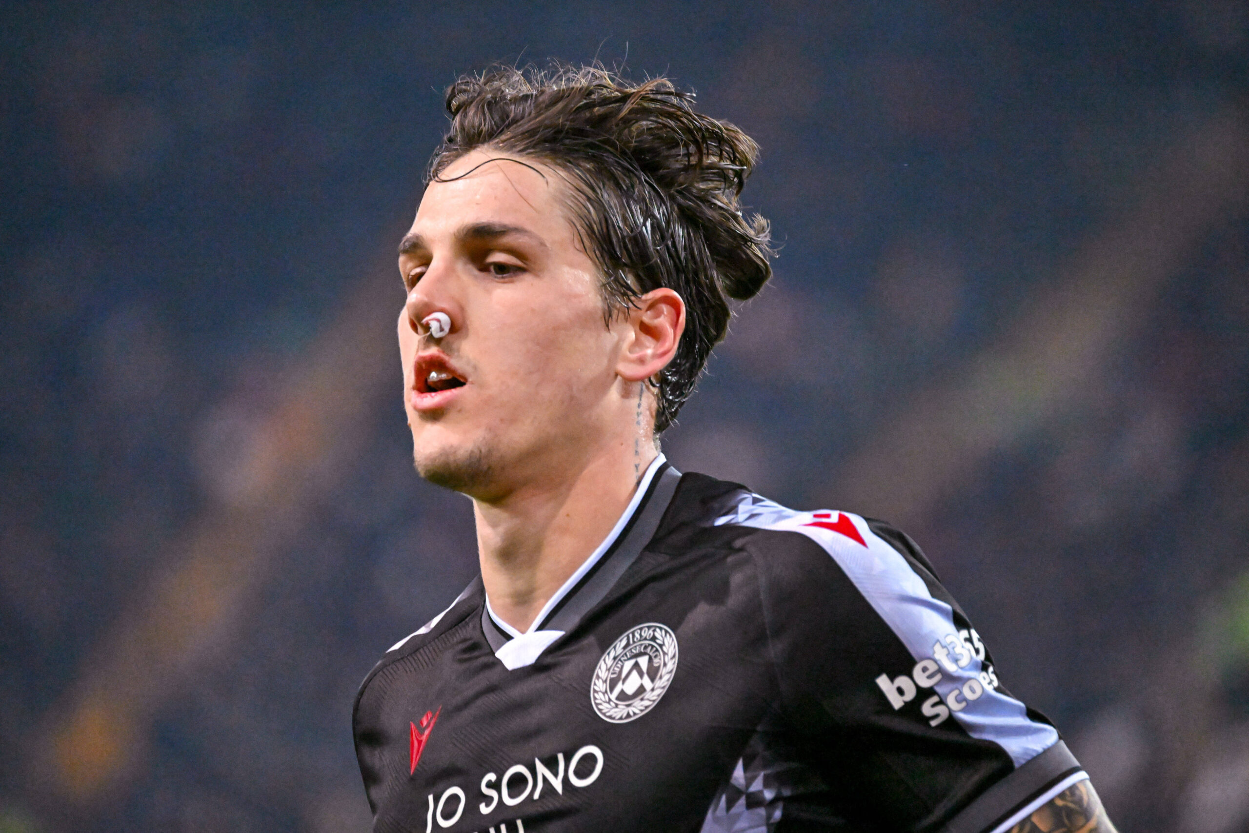 Zaniolo dopo essere stato medicato